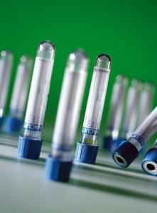 Probówki do koagulologii Vacuette 9 ml  50 szt.